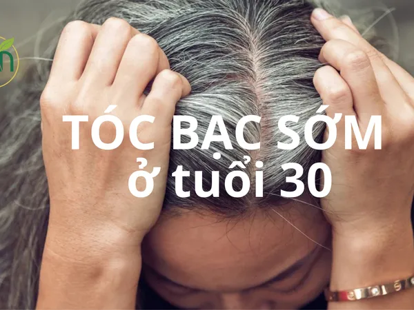 TÓC BẠC SỚM ở tuổi 30