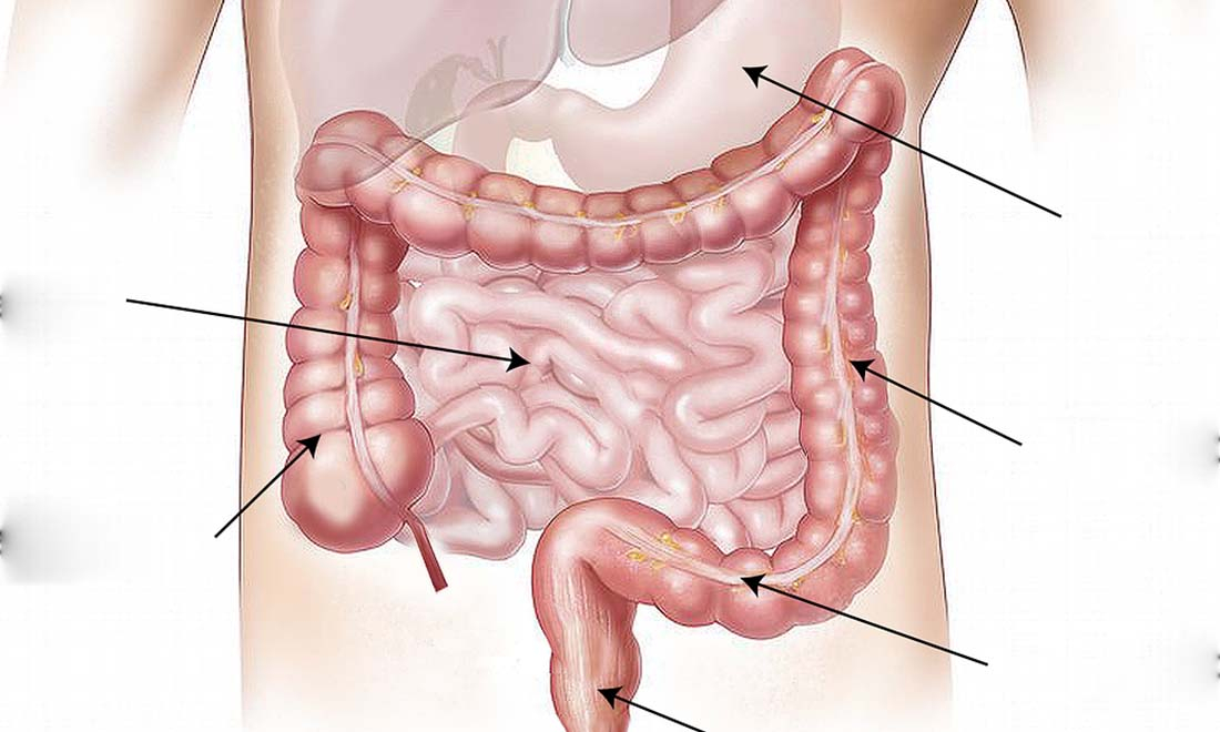 Các Nguyên nhân gây tổn hại hệ lợi khuẩn, gây ra hội chứng rò rỉ ruột Các Nguyên nhân gây tổn hại hệ lợi khuẩn, gây ra hội chứng rò rỉ ruột