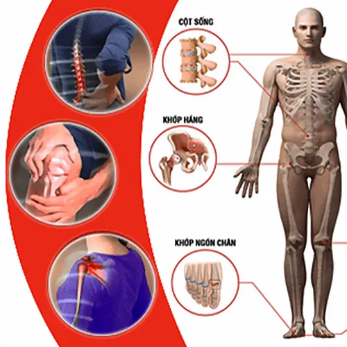 Trị Liệu Đau Cơ Xương Khớp tại Hà Nội