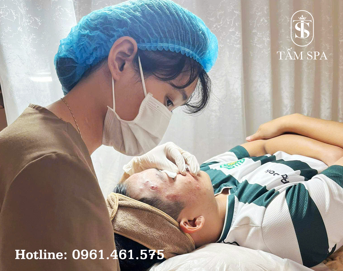 Lấy Mụn Chuẩn Y Khoa Chuyên Sâu Giải Pháp Tối Ưu Cho Làn Da Khỏe Mạnh Lấy Mụn Chuẩn Y Khoa Chuyên Sâu Giải Pháp Tối Ưu Cho Làn Da Khỏe Mạnh