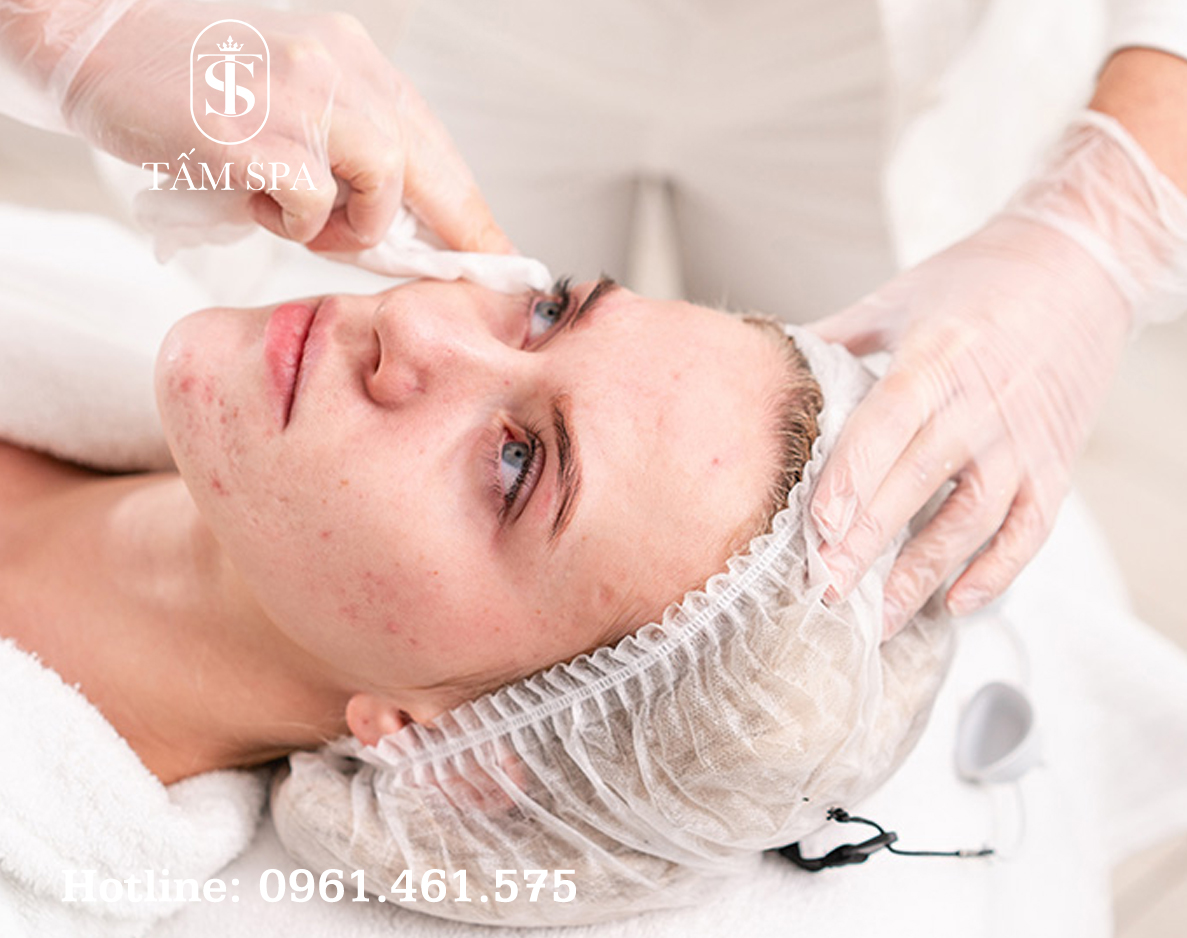 Dịch Vụ Lấy Nhân Mụn Chuẩn Y Khoa Chuyên Sâu Tại Tấm Spa Dịch Vụ Lấy Nhân Mụn Chuẩn Y Khoa Chuyên Sâu Tại Tấm Spa