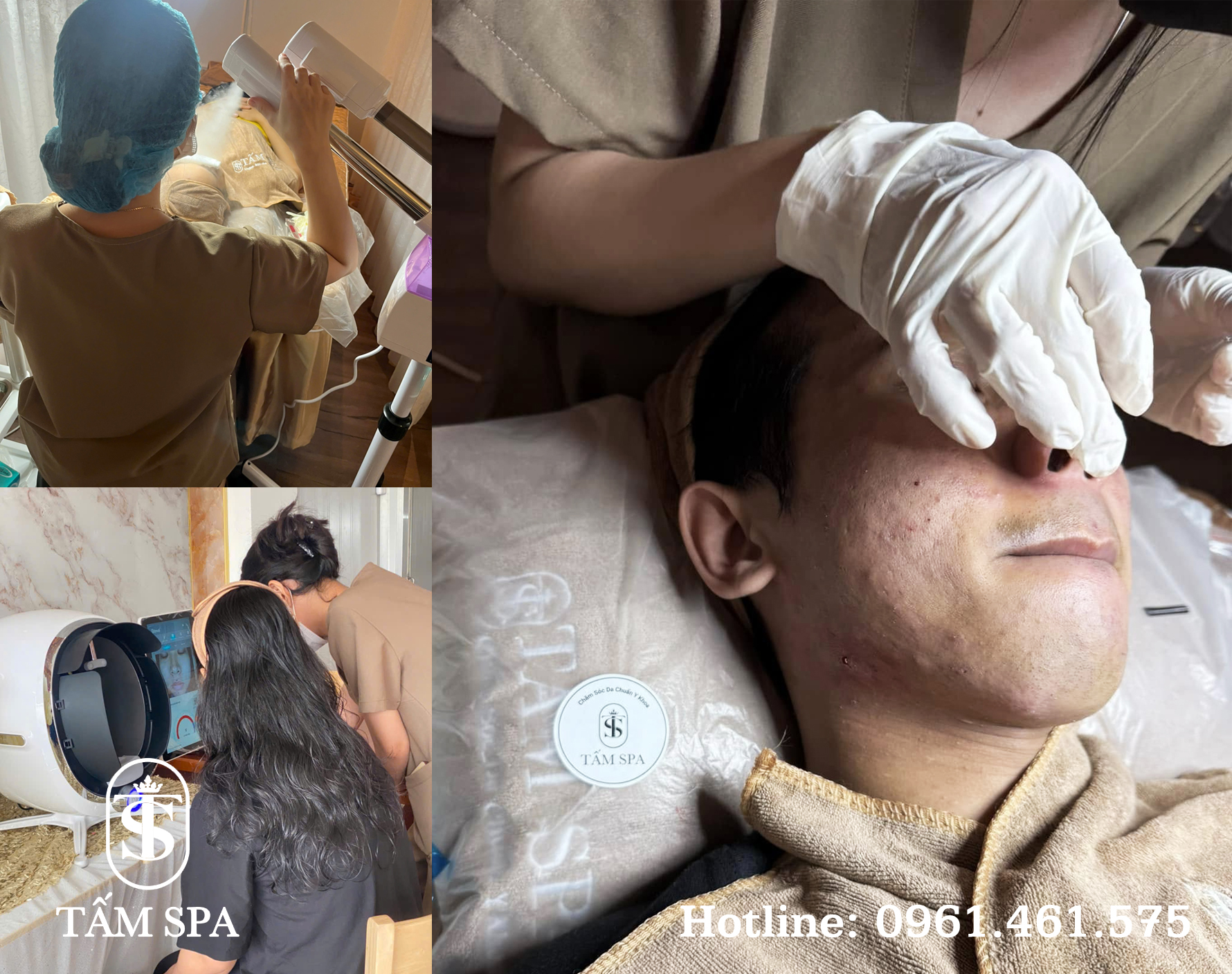 Lấy Mụn Chuẩn Y Khoa Chuyên Sâu Giải Pháp Tối Ưu Cho Làn Da Khỏe Mạnh Lấy Mụn Chuẩn Y Khoa Chuyên Sâu Giải Pháp Tối Ưu Cho Làn Da Khỏe Mạnh