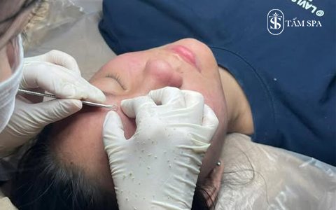 Tấm Spa Trị Mụn Quận 12 Uy Tín Hiệu Quả Ngay Từ Liệu Trình Đầu Tiên Tấm Spa Trị Mụn Quận 12 Uy Tín Hiệu Quả Ngay Từ Liệu Trình Đầu Tiên