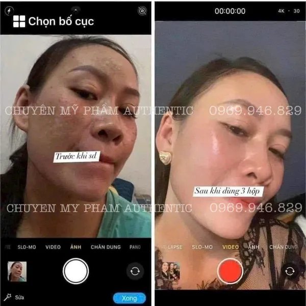 Kem Meiduzi Nhật Bản giúp trắng da và mờ nám – Dòng kem ngày