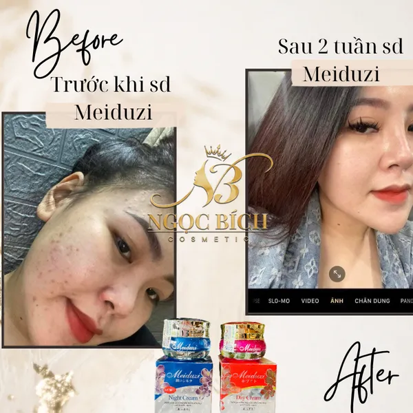 Kem Dưỡng Trắng Da Meiduzi, trị mụn ,mờ thâm nám hiệu quả