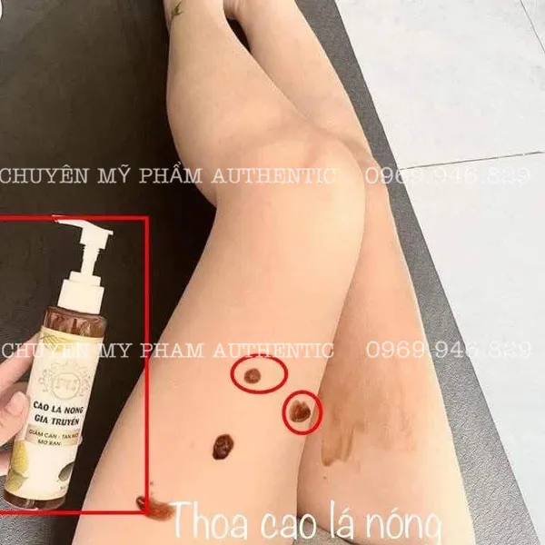 COMBO CAO LÁ NÓNG GIA TRUYỀN - GIẢM CÂN - TAN MỠ - RẠN 200ml