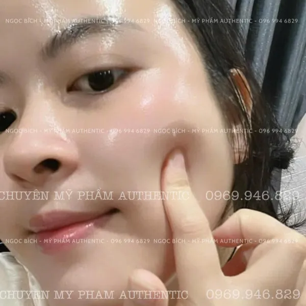 Serum Tinh Chất Mật Ong Nikos Beauty Phiên Bản Mới 10ML ( Khuyến Mãi giảm 10%)