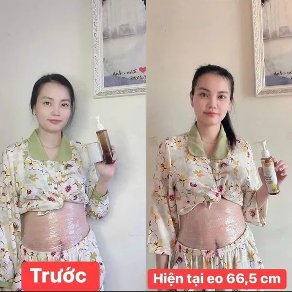 COMBO CAO LÁ NÓNG GIA TRUYỀN - GIẢM CÂN - TAN MỠ - RẠN 200ml