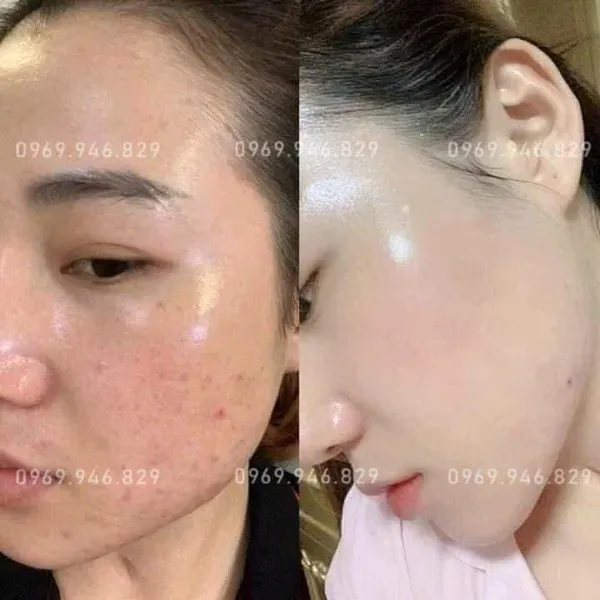 Kem Meiduzi Nhật Bản giúp trắng da và mờ nám – Dòng kem ngày