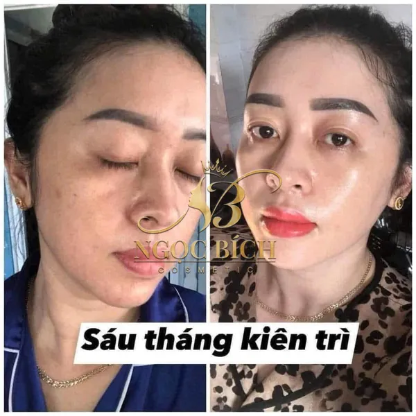 Kem Dưỡng Trắng Da Meiduzi, trị mụn ,mờ thâm nám hiệu quả