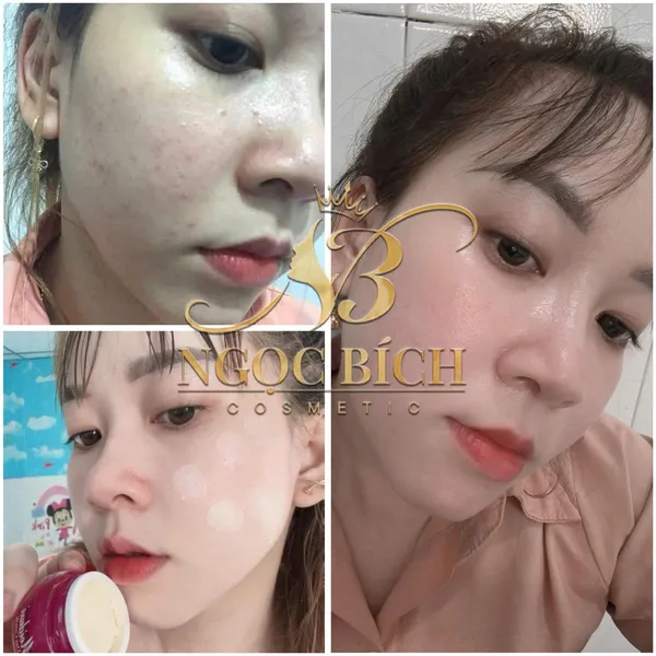 Kem Meiduzi Nhật Bản giúp trắng da và mờ nám – Dòng kem ngày