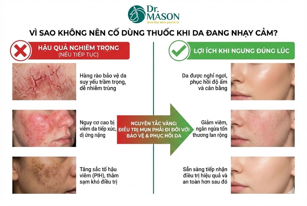 vì sao không nên cố dùng thuốc khi da đang nhạy cảm