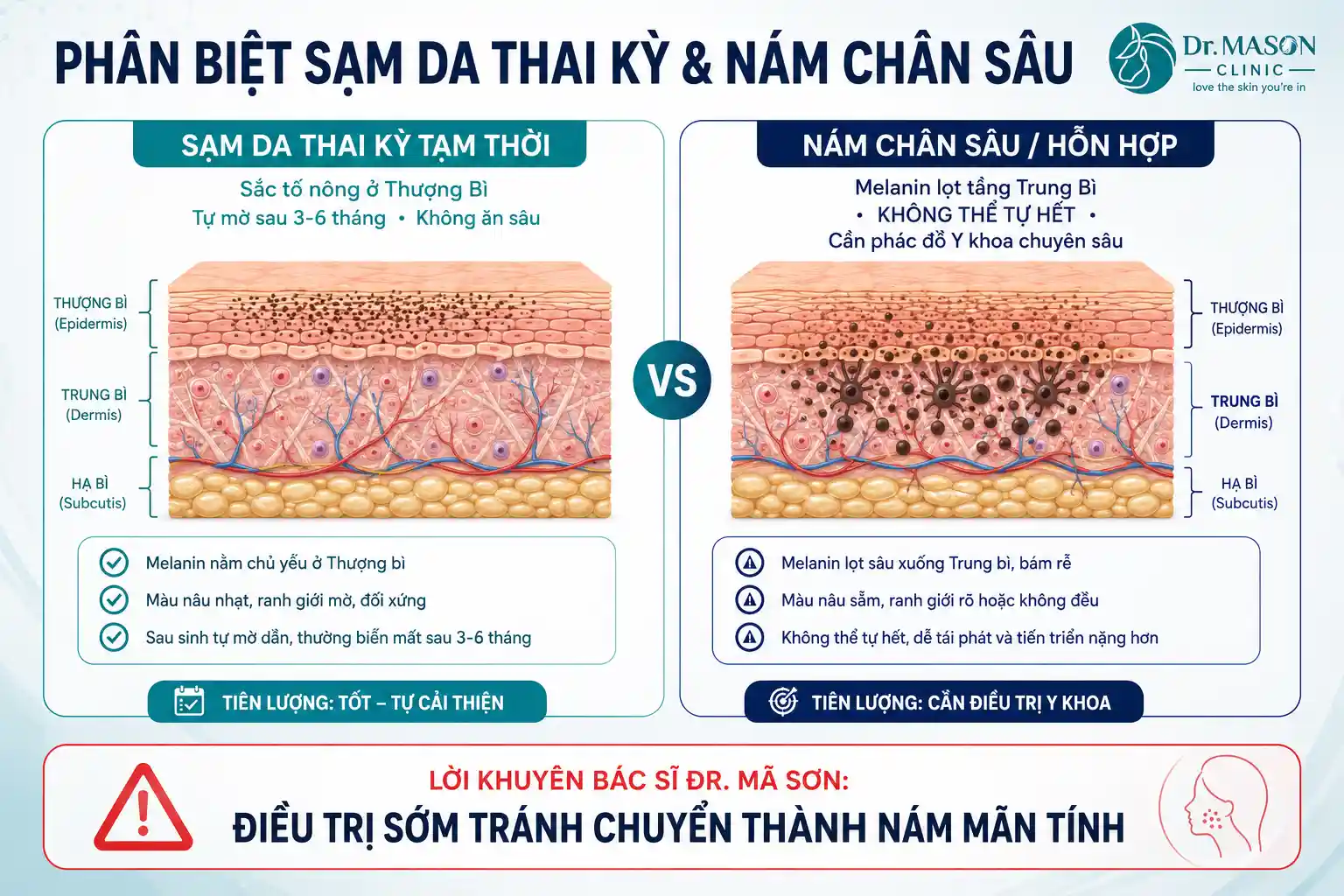 Phân biệt sạm da thai kỳ và nám chân sâu