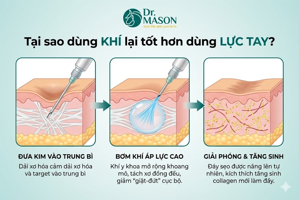 tại sao bóc tách sẹo khí lại tốt hơn tay