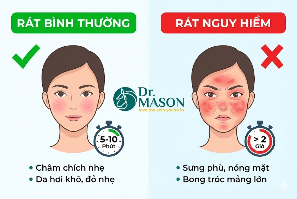 phân biệt rát bình thường và rát nguy hiểm