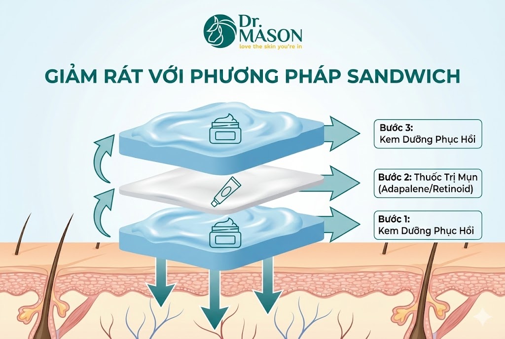 cách giảm rát bằng phương pháp sadwitch