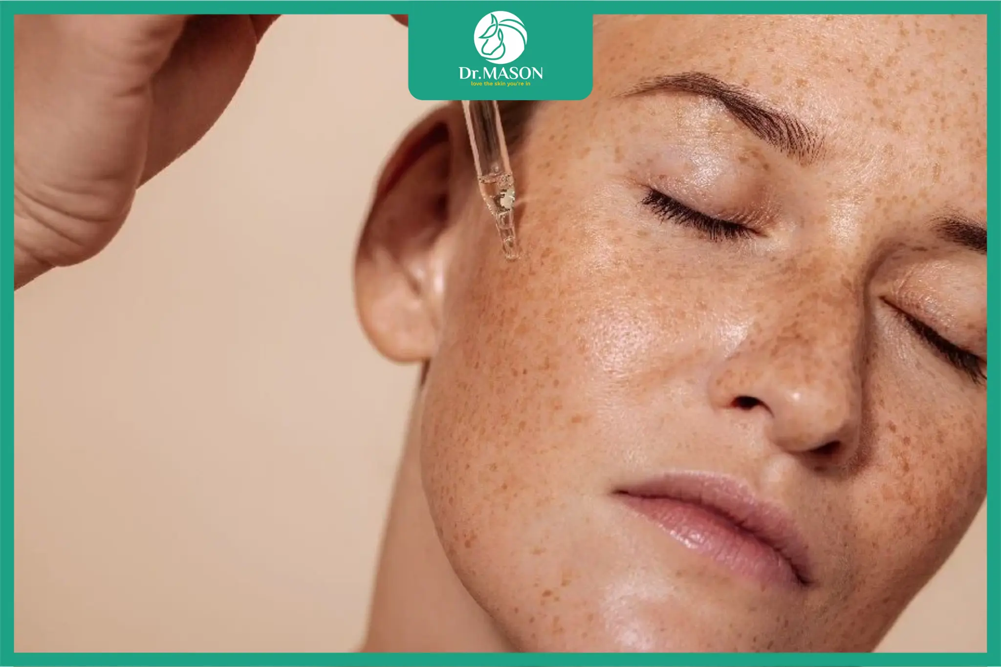 các thành phần tránh khi da bị nám sạm