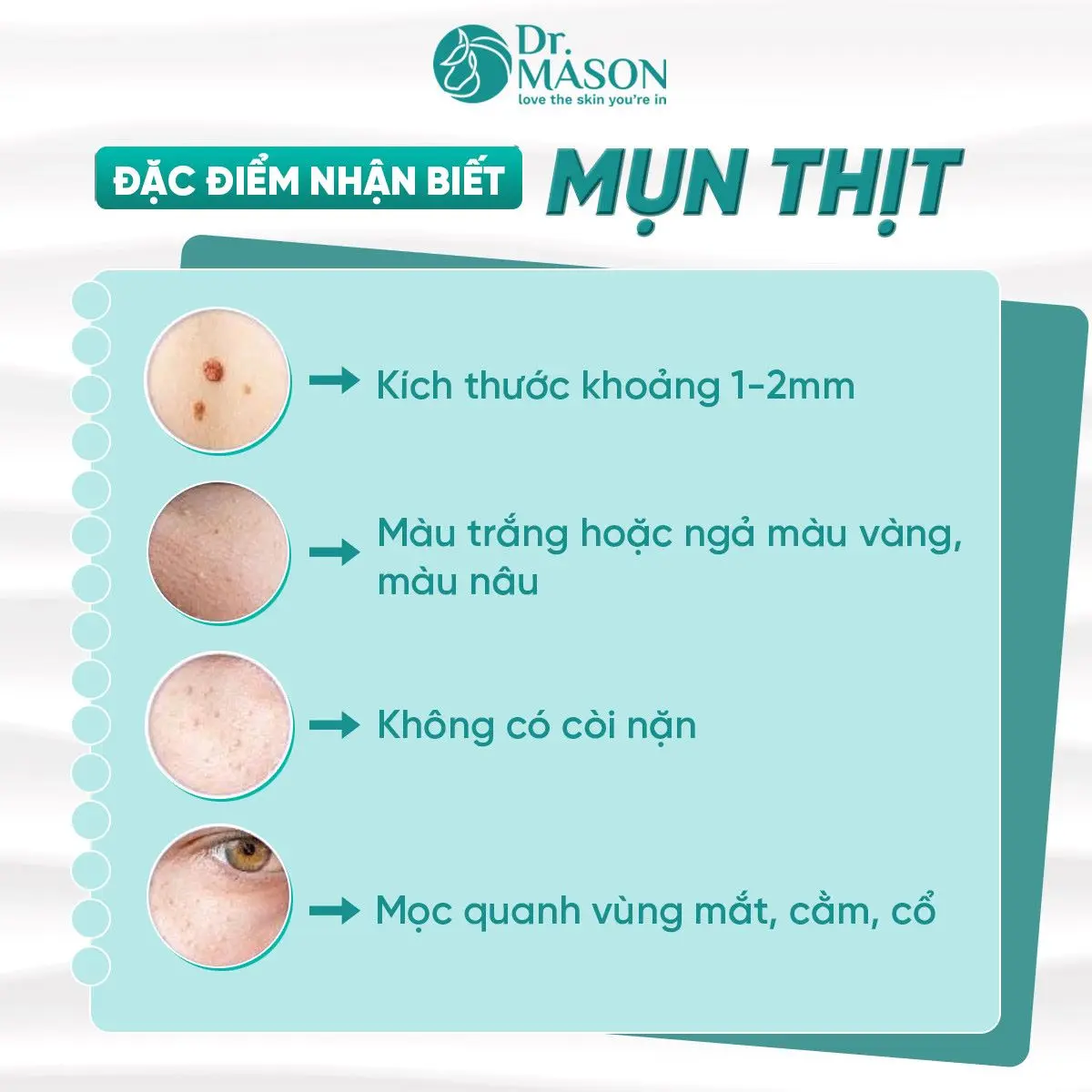 đặc điểm nhận biết mụn thịt