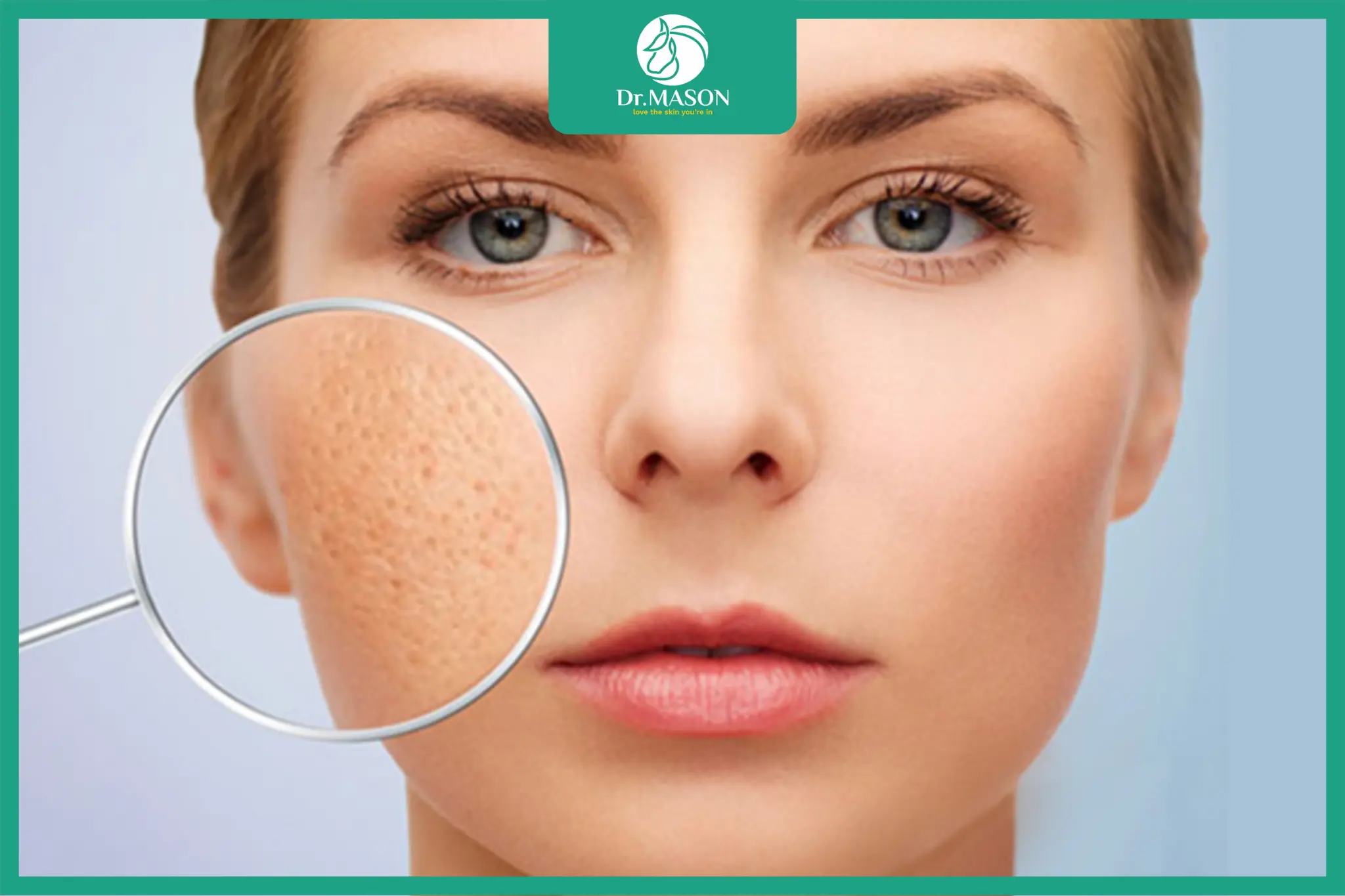 cận cảnh sẹo rỗ