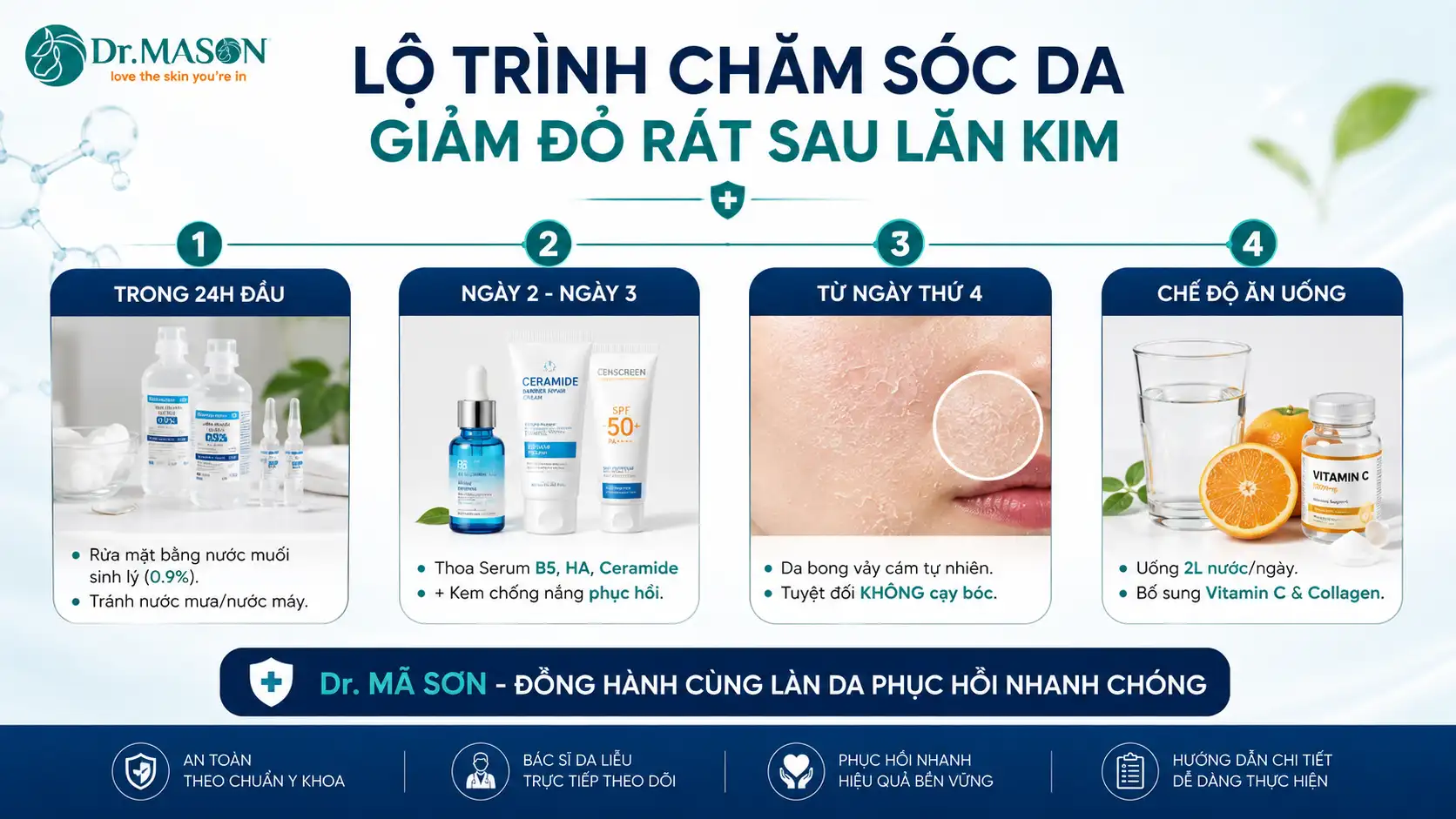 Hướng dẫn chăm sóc da sau lăn kim sẹo rỗ