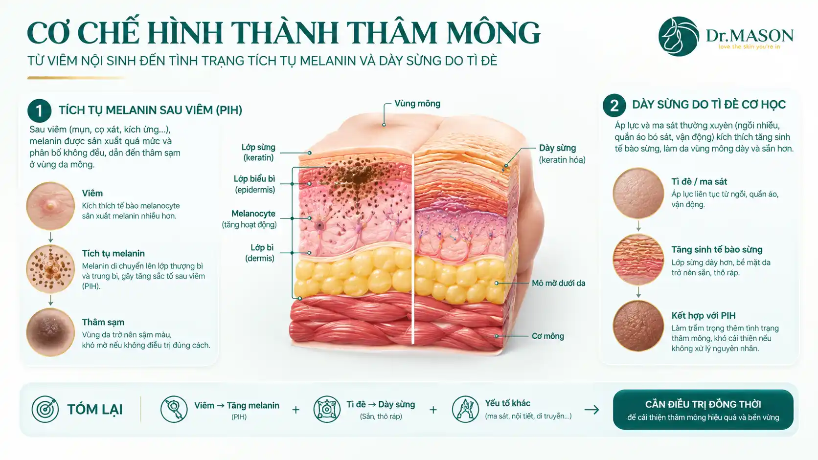 Cơ chế hình thành thâm sạm vùng mông