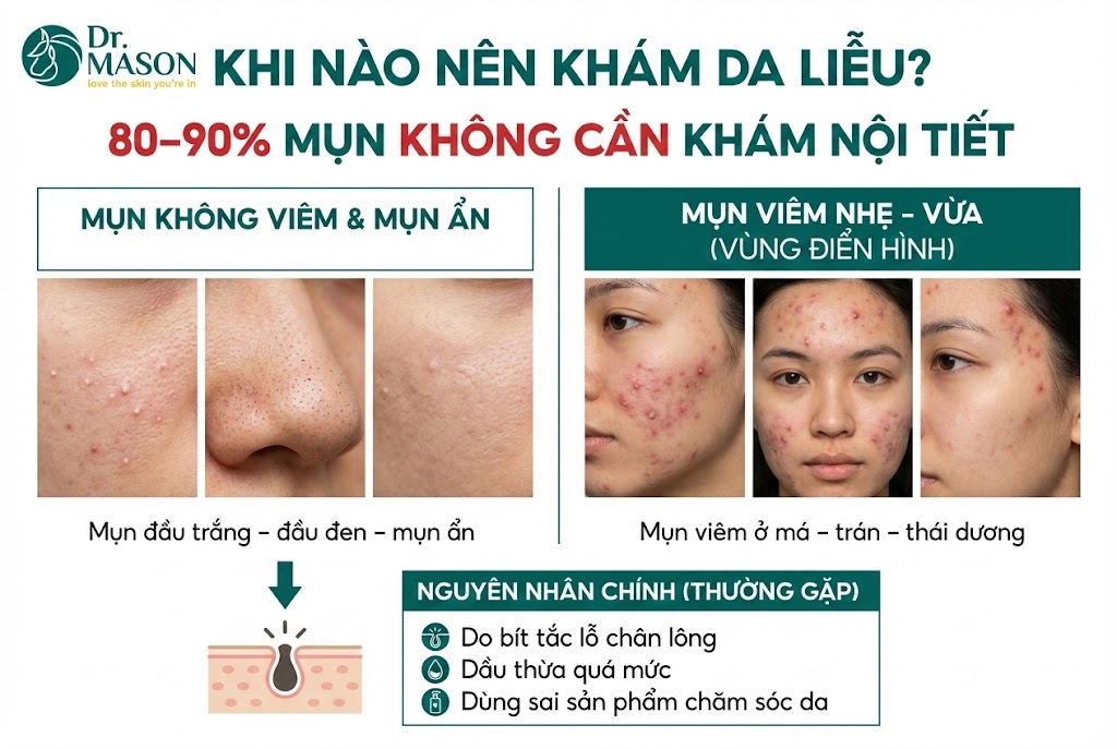 80% là nên đi khám da liễu trước