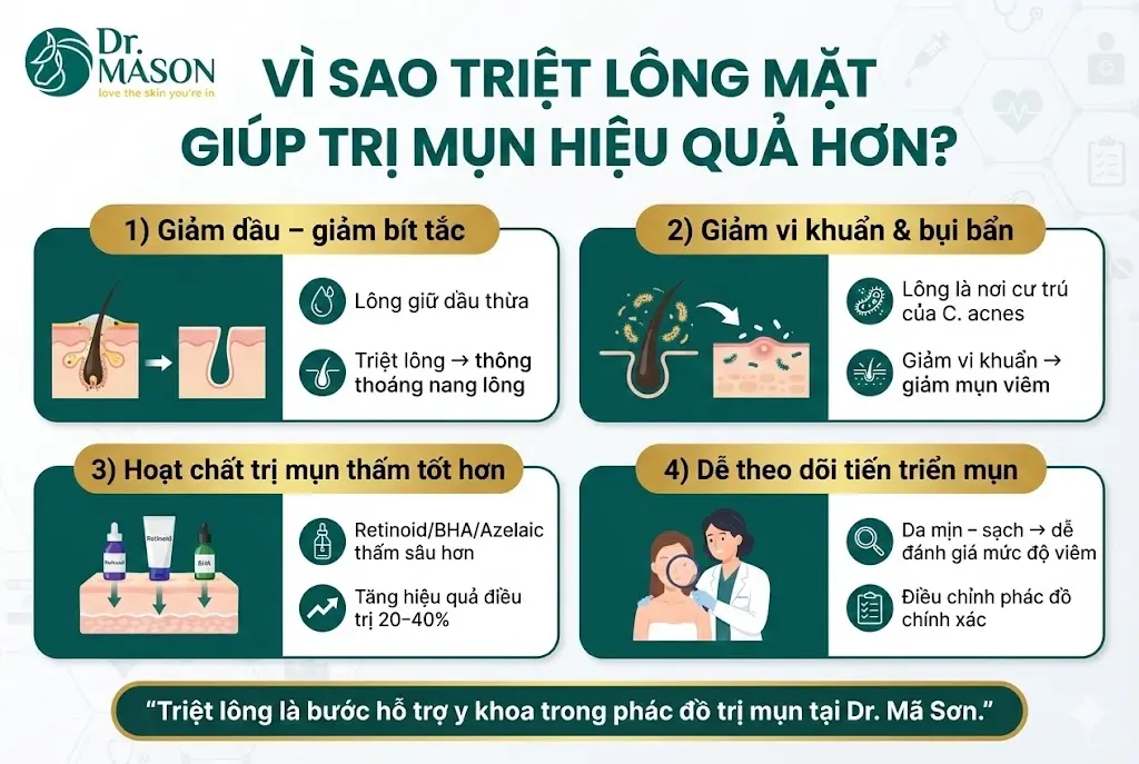 vif sao triệt lông mặt giúp trị mụn hiệu quả hơn