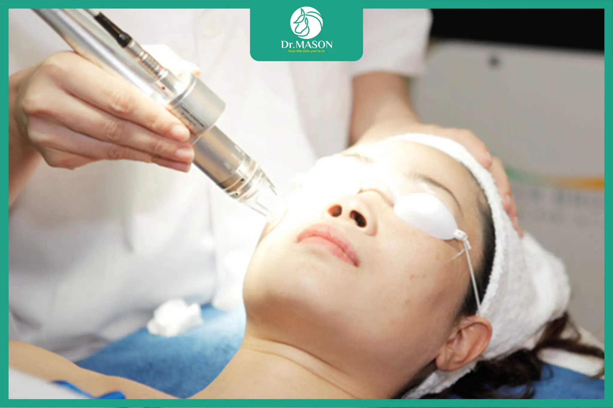 F.A.S.T – phương pháp tiên tiến điều trị sẹo rỗ hiệu quả cá nhân hóa