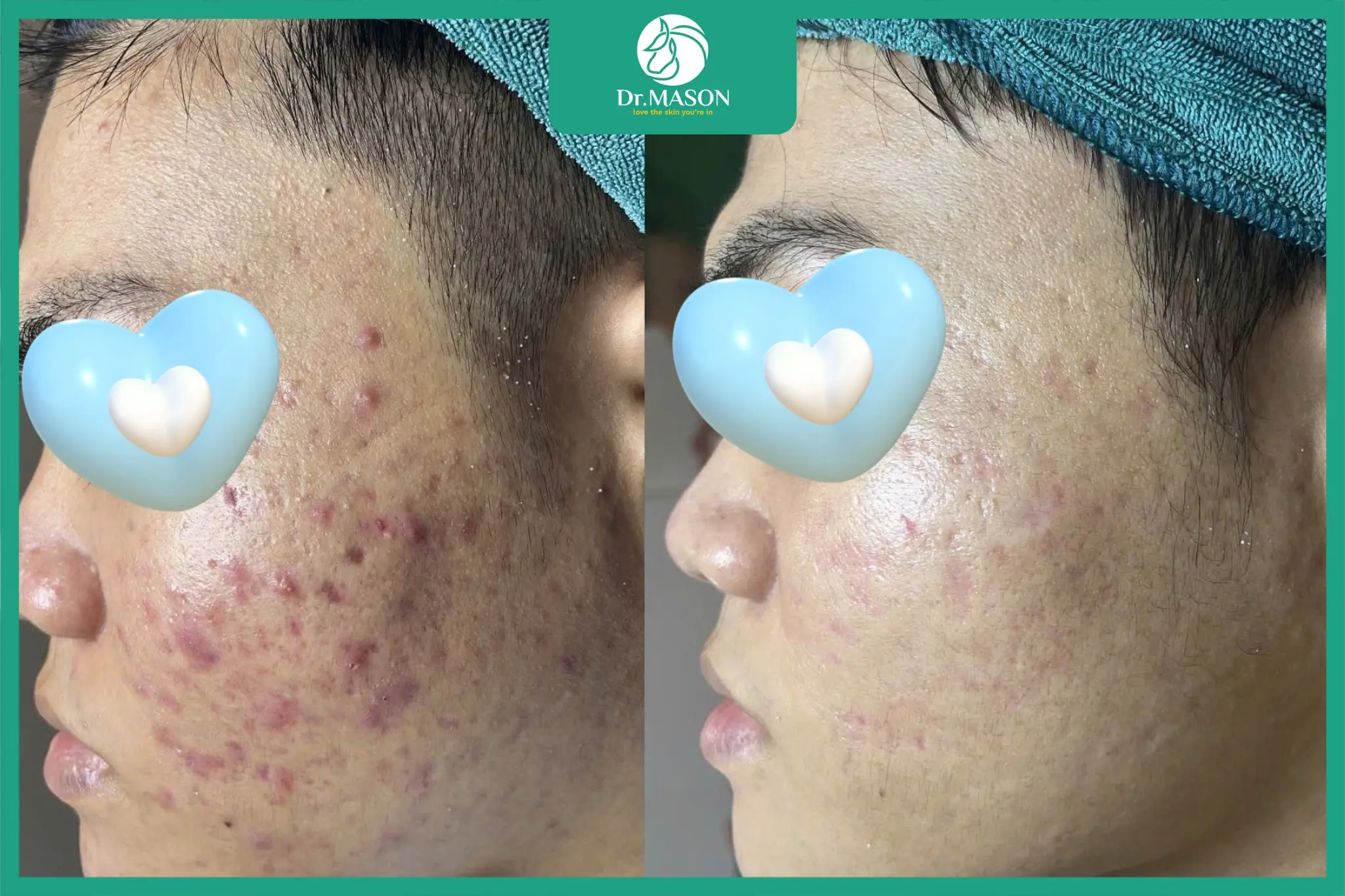 hình ảnh khách hàng sau điều trị của bác sĩ