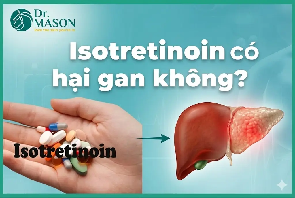 uống Isotretinoin có hại gan không
