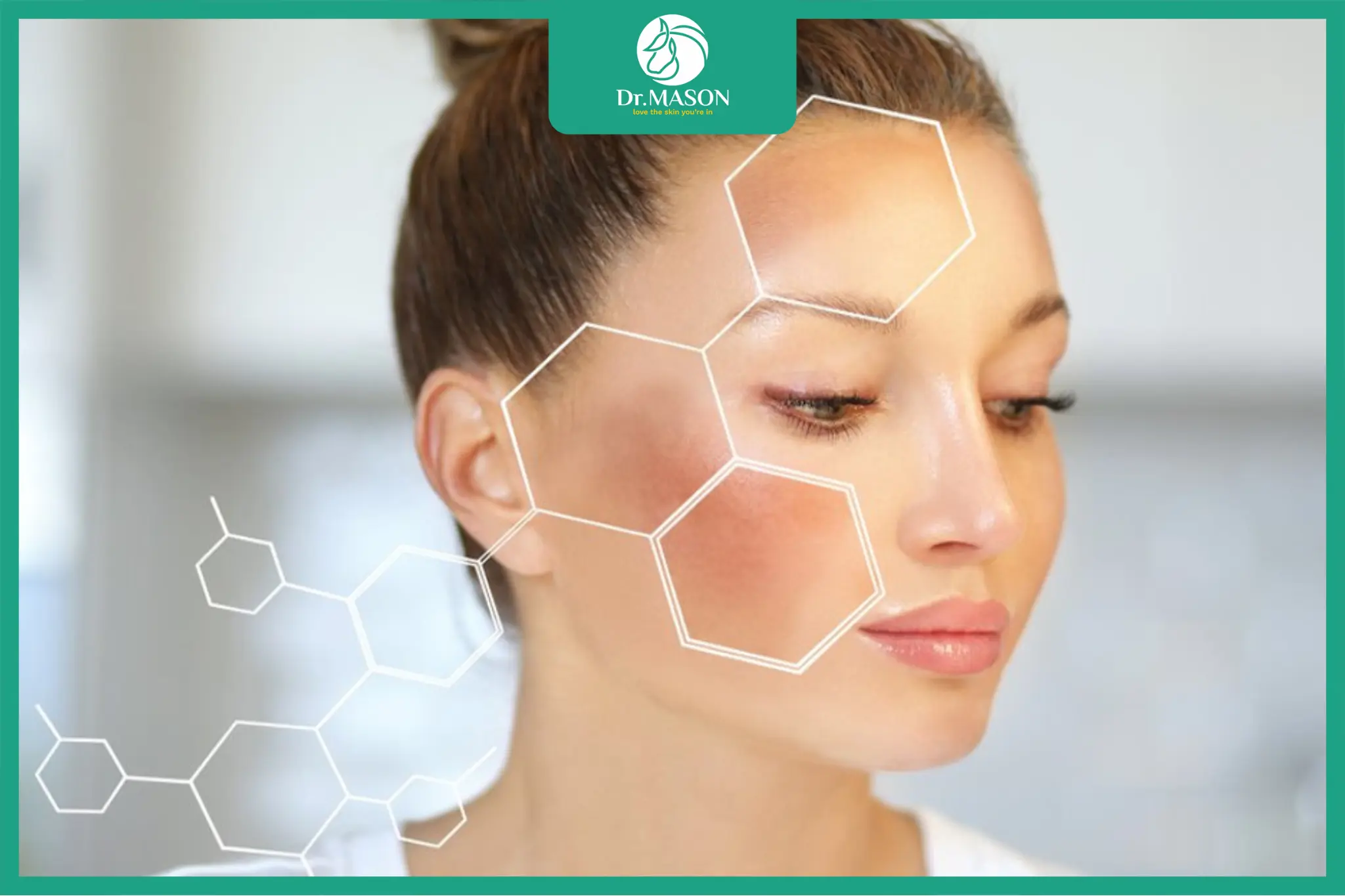 kết quả trẻ hóa da