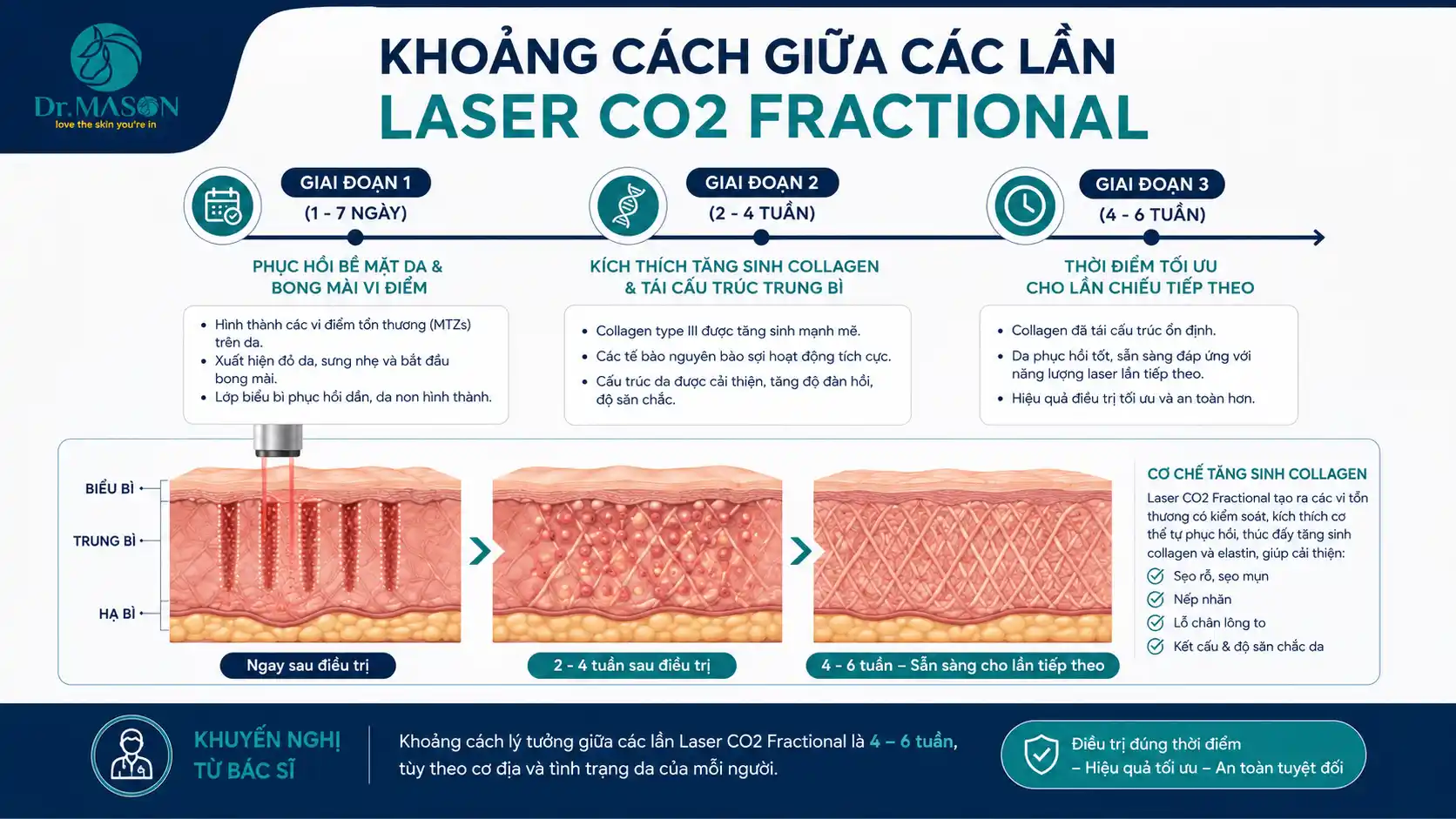 Khoảng cách giữa các lần Laser CO2 Fractional