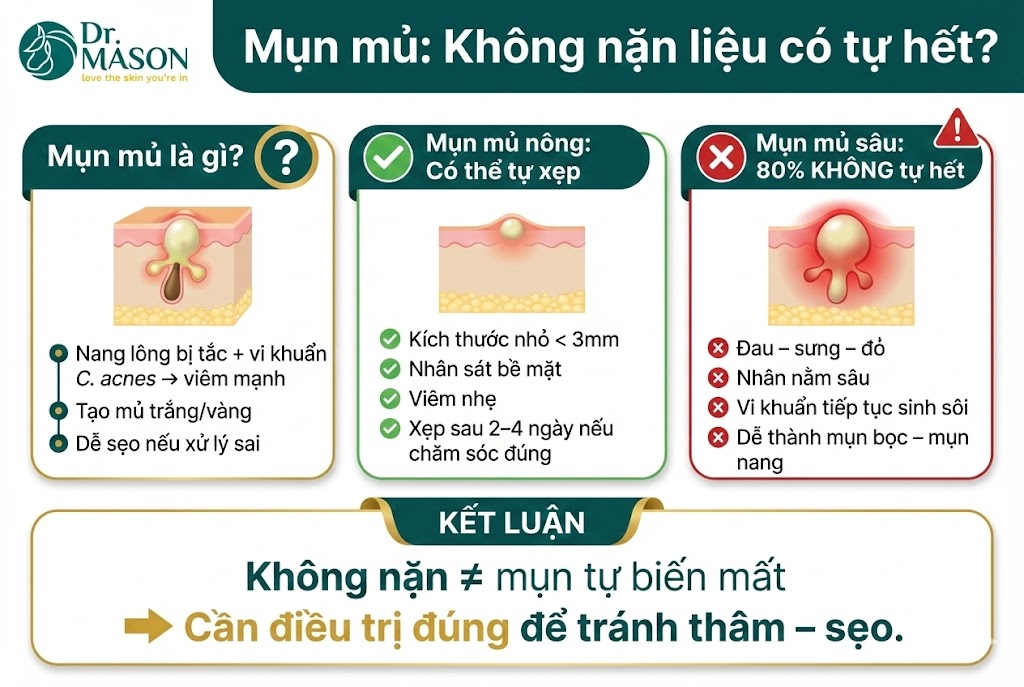 mụn mủ không nặn tự hết
