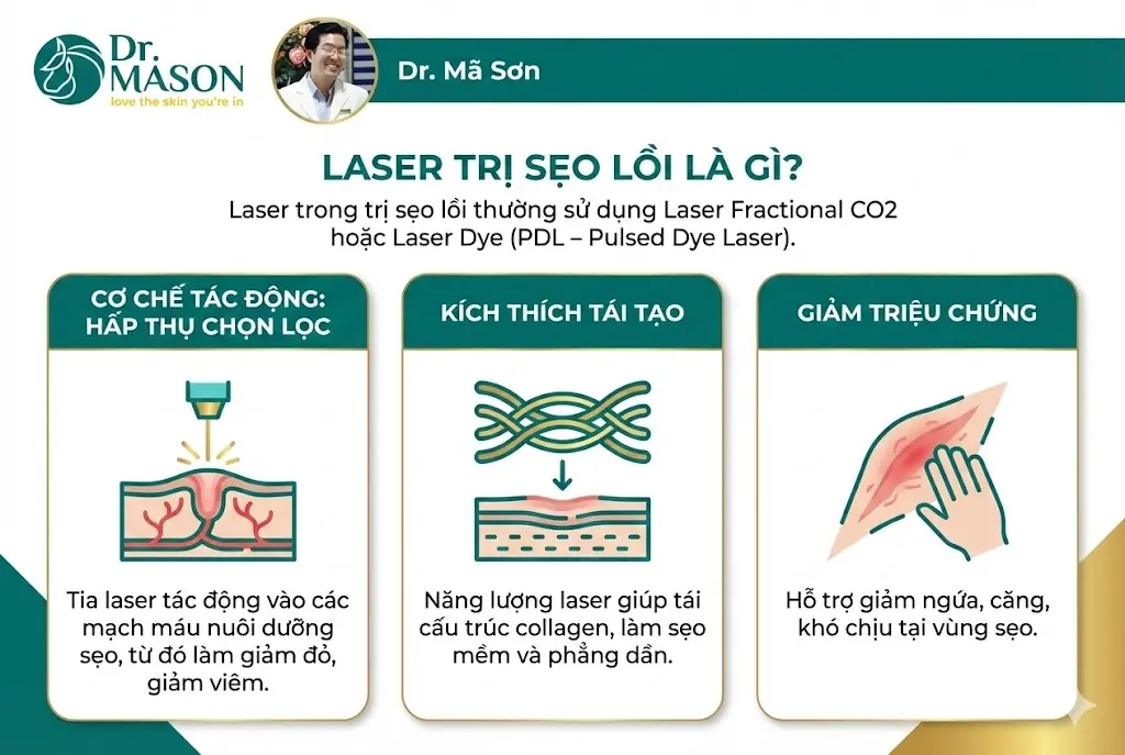 laser trị sẹo lồi là gì?
