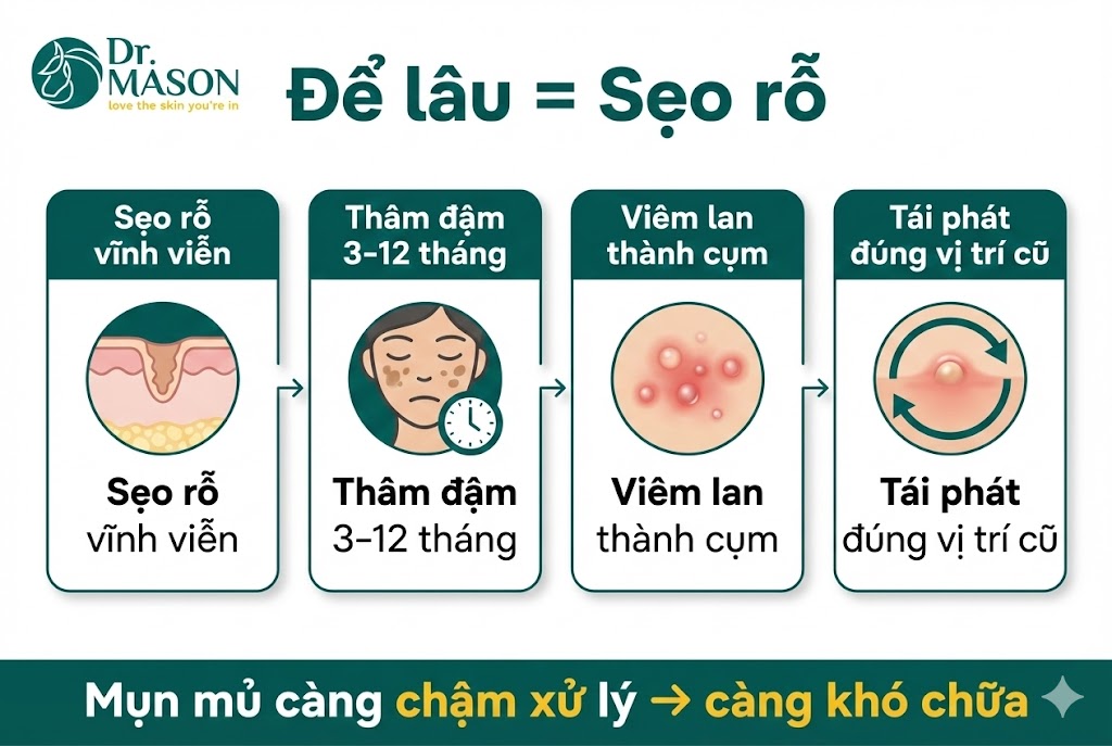để mụn mủ lâu bằng sẹo rỗ