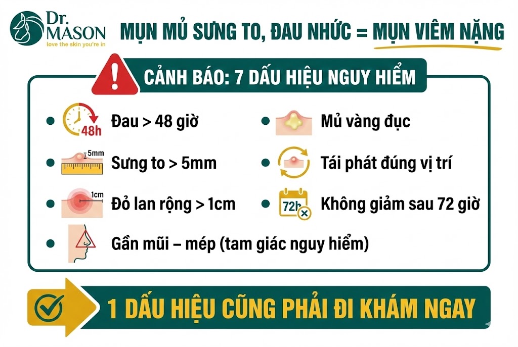 mụn sưng to đau nhức là mụn viêm nặng