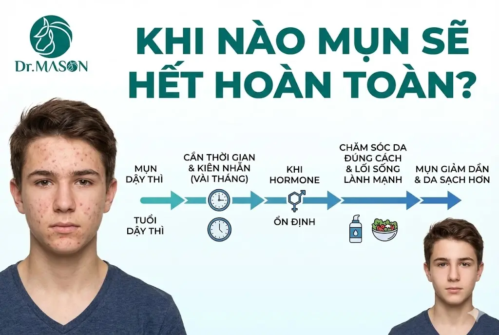 khi nào hết mụn dậy thì