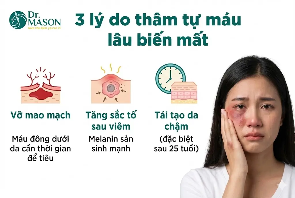 3 lý do tại sao máu thâm tụ lại lâu hết