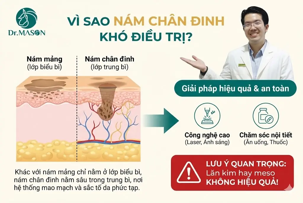 cách điều trị nám chân đinh