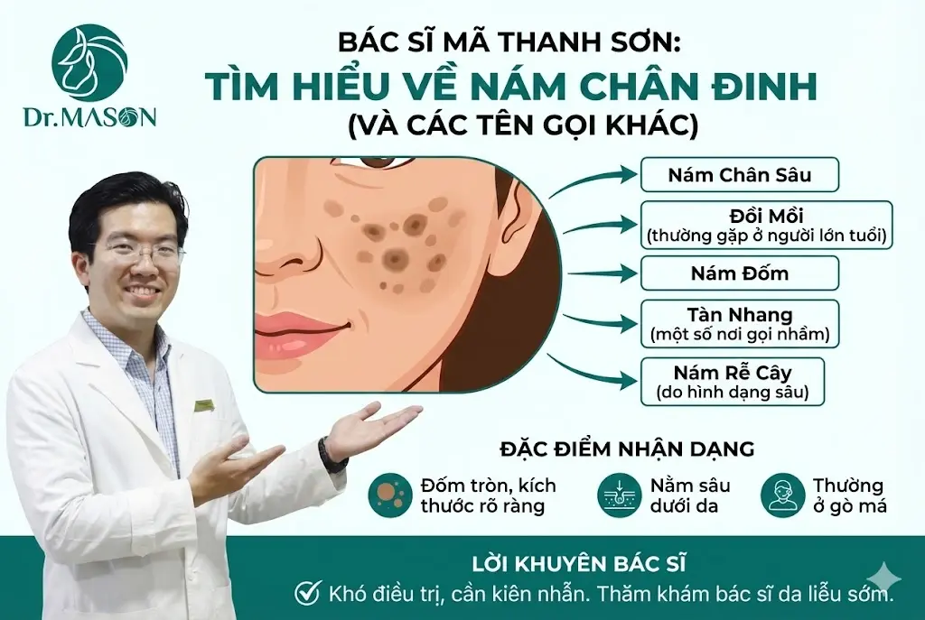 các tên gọi khác của nám chân đinh