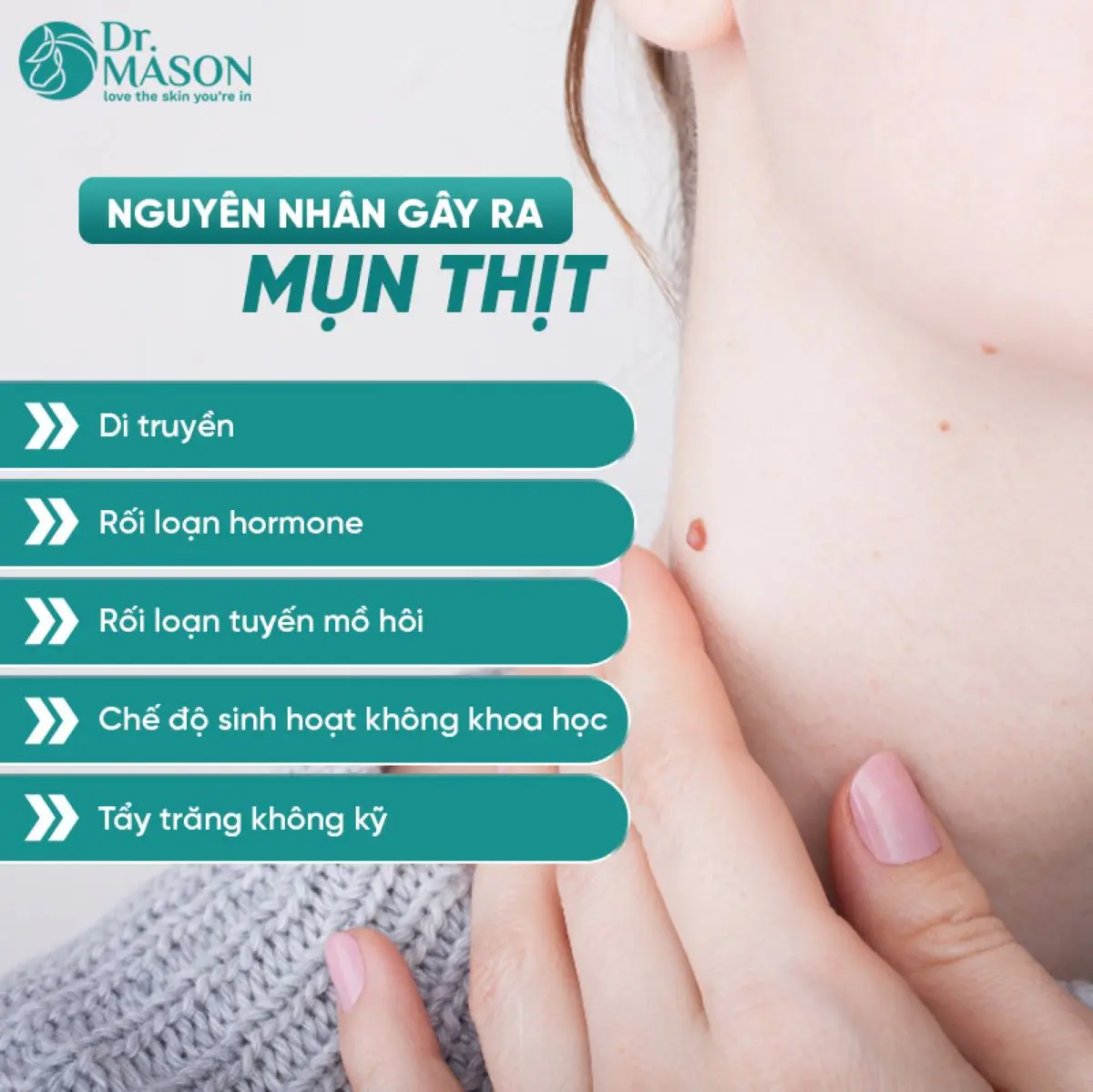 các nguyên nhân thường gặp mụn thịt