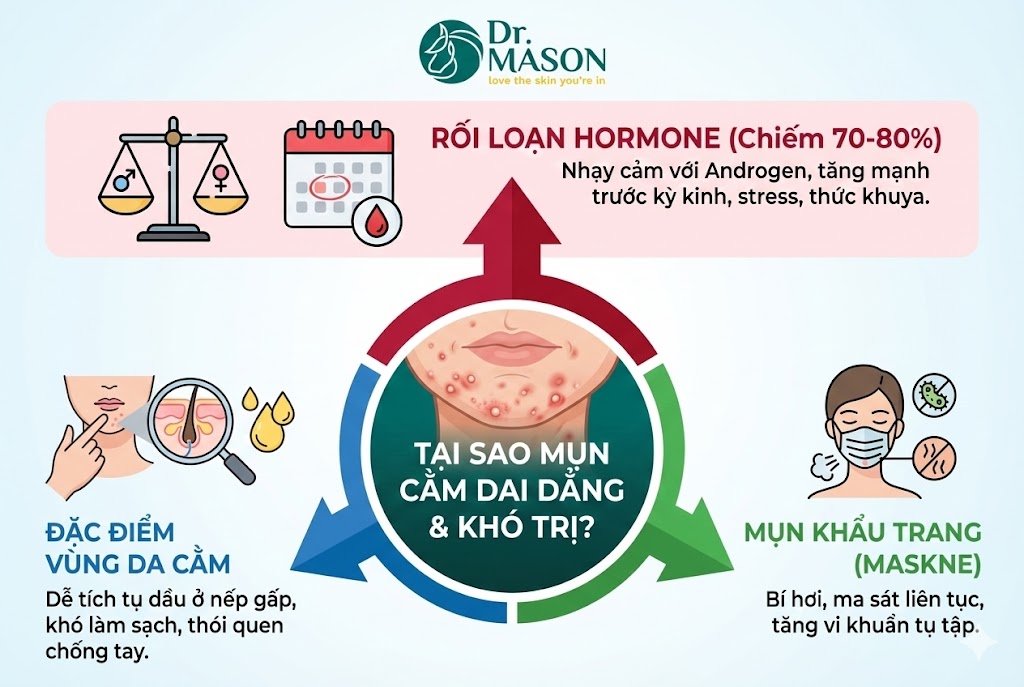 nguyên nhân nổi mụn cằm