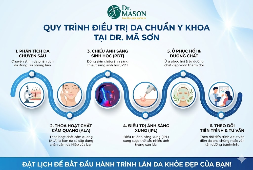 quy trình điều trị mụn IPL- PDT