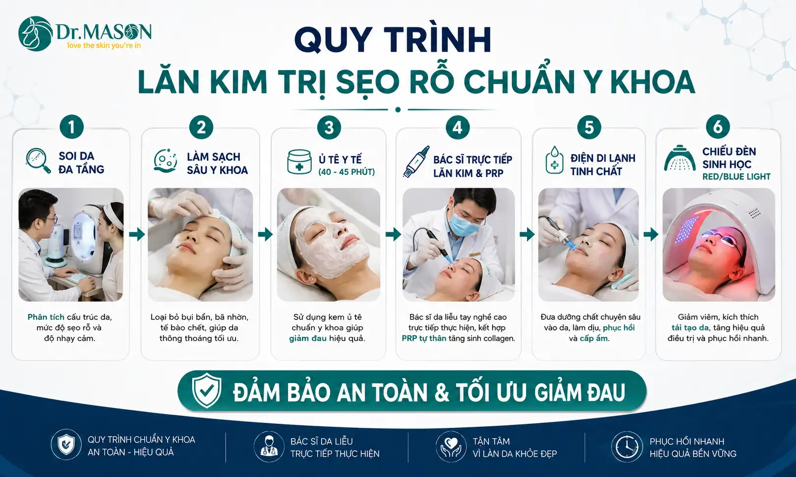 Quy trình lăn kim trị sẹo rỗ tại Dr Mã Sơn