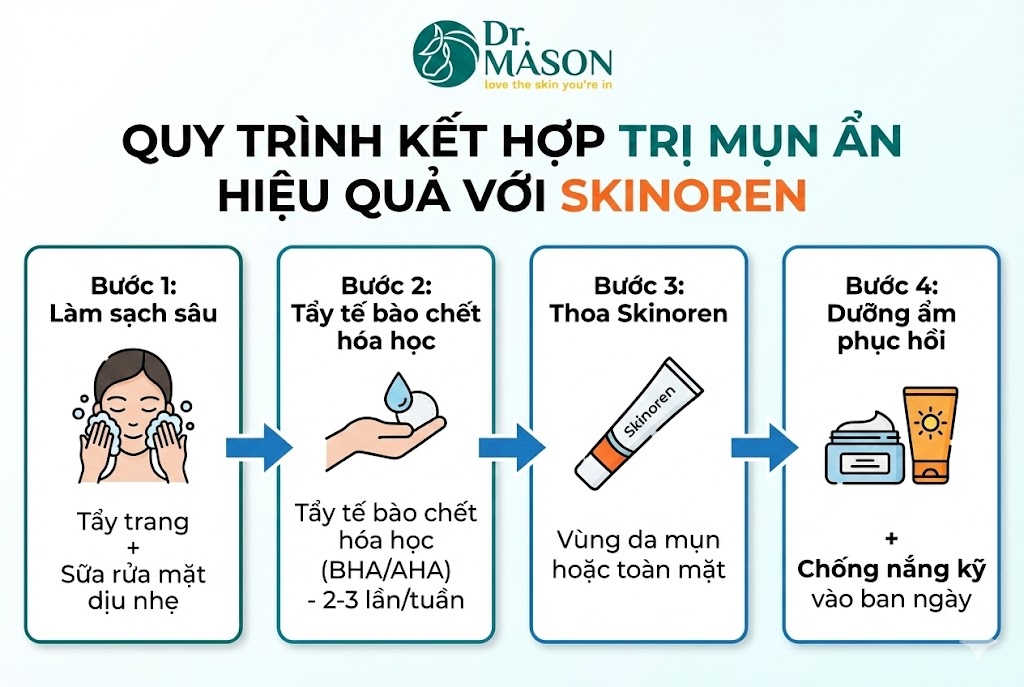 quy trình kết hợp skinoren trị mụn ẩn hiệu quả