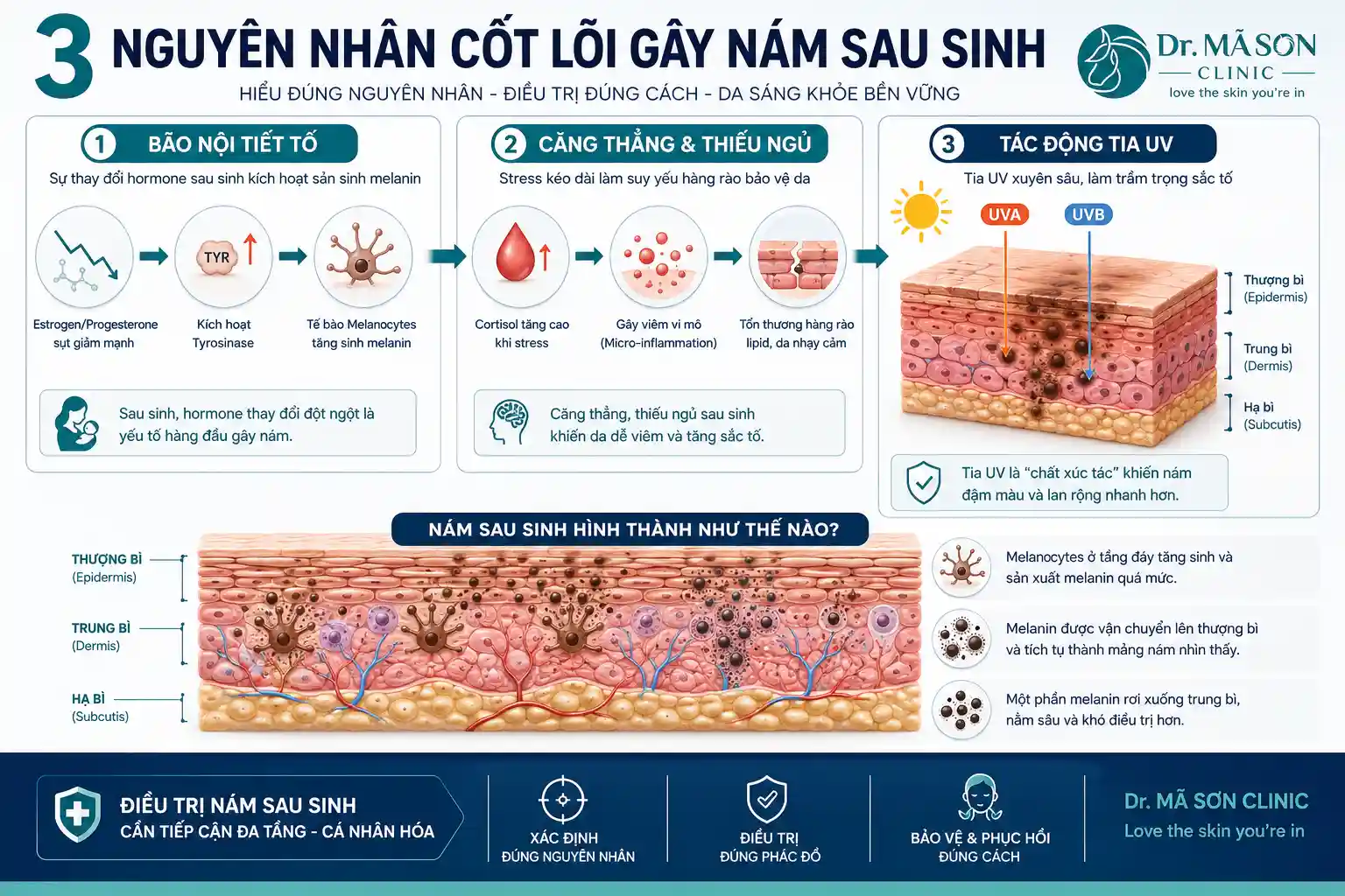 Sơ đồ nguyên nhân gây nám sau sinh