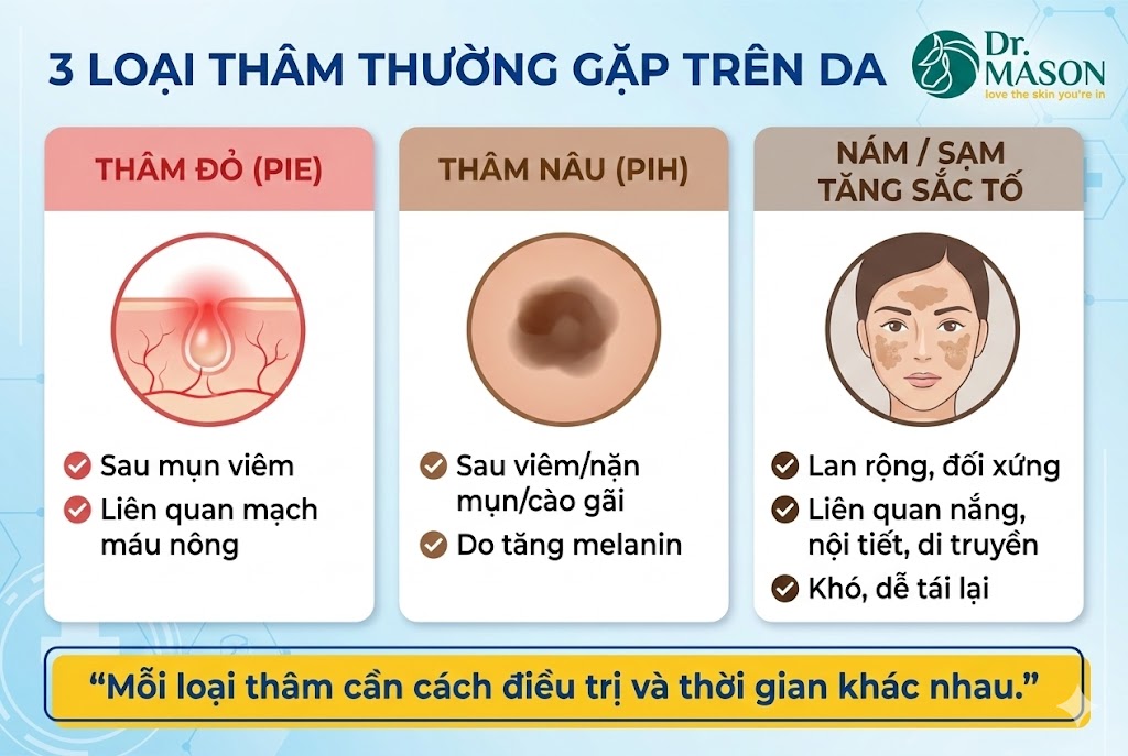 3 loại thâm thường gặp trên da