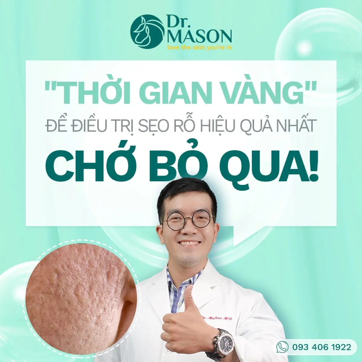 thời gian vang điều trị sẹo không nên bỏ qua