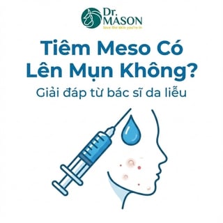Nguyên nhân và cách xử lý nổi mụn sau tiêm meso