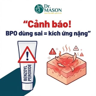 Cách dùng Benzoyl Peroxide an toàn, tránh kích ứng